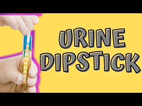 Home Tests for UTI Using “Urine Dipstick” with Dr. Robert Chan at Home