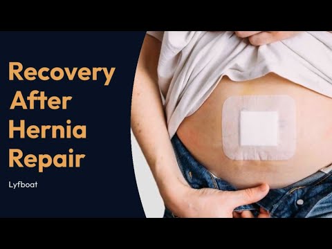 Recover After Hernia Repair Surgery | Lyfboat