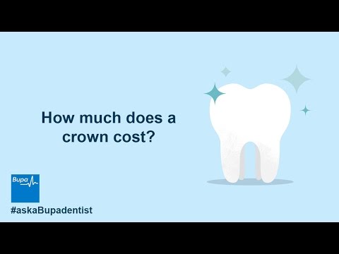 How much does a crown cost?