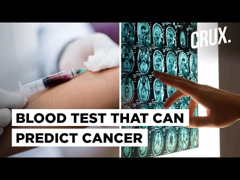 Cancer Breakthrough? Blood Test Can Diagnose Cancer In Earliest Stage Or Tell You're Safe For A Year