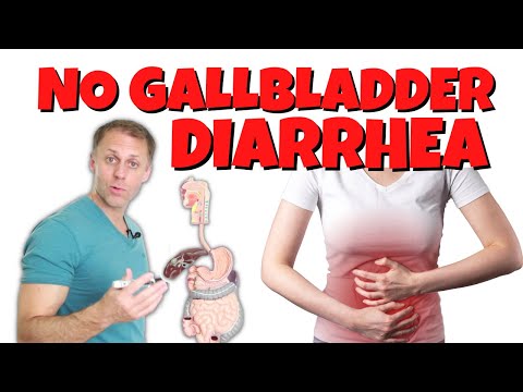 Diarrhea or Loose Stools After Gallbladder Removal